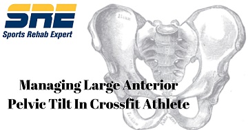 Managing Large Anterior Pelvic Tilt In Crossfit Athlete