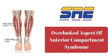 Overlooked Aspect Of Anterior Compartment Syndrome