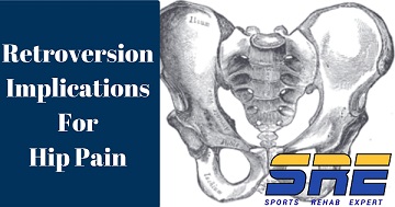 Hip Retroversion Implications For Hip Pain