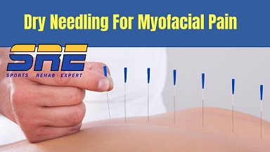 Dry Needling for Myofascial Pain