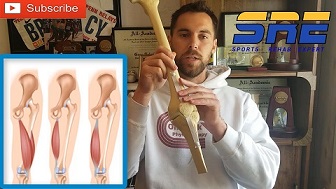 Complete Guide For IT Band Pain with Full Rehab Program