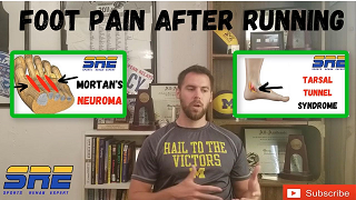 Foot Pain After Running &##x7c; Tarsal Tunnel Syndrome & Morton&##x27;s Neuroma Treatment