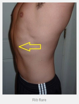 Should We Train the Rectus Abdominus&##x3f;