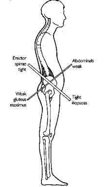 Should We Train the Rectus Abdominus&##x3f;